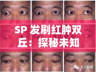 SP 发刷红肿双丘：探秘未知的奥秘